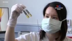 Գերմանիան փորձում է կովիդ 19-ով տառապող անձանց բուժել ապաքինվածների իմունային պլազմայով