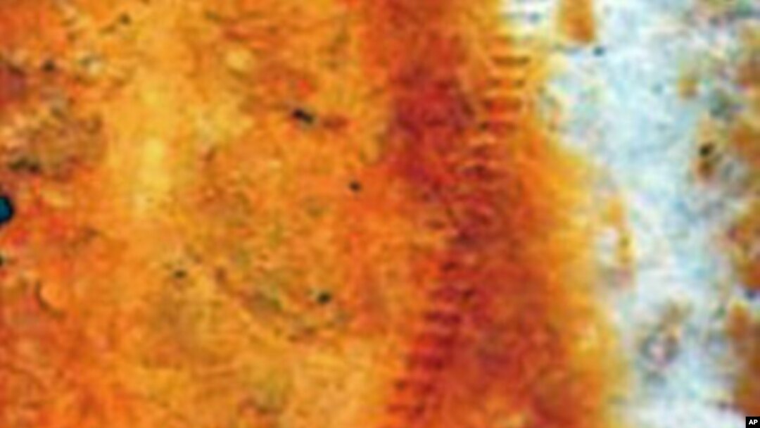 A vein of the fossilized katydid wing shows a row of teeth for song-making. About 72mm across, the wing is larger than a modern katydid's.