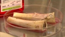 Lab-grown Bones Successfully Transplanted