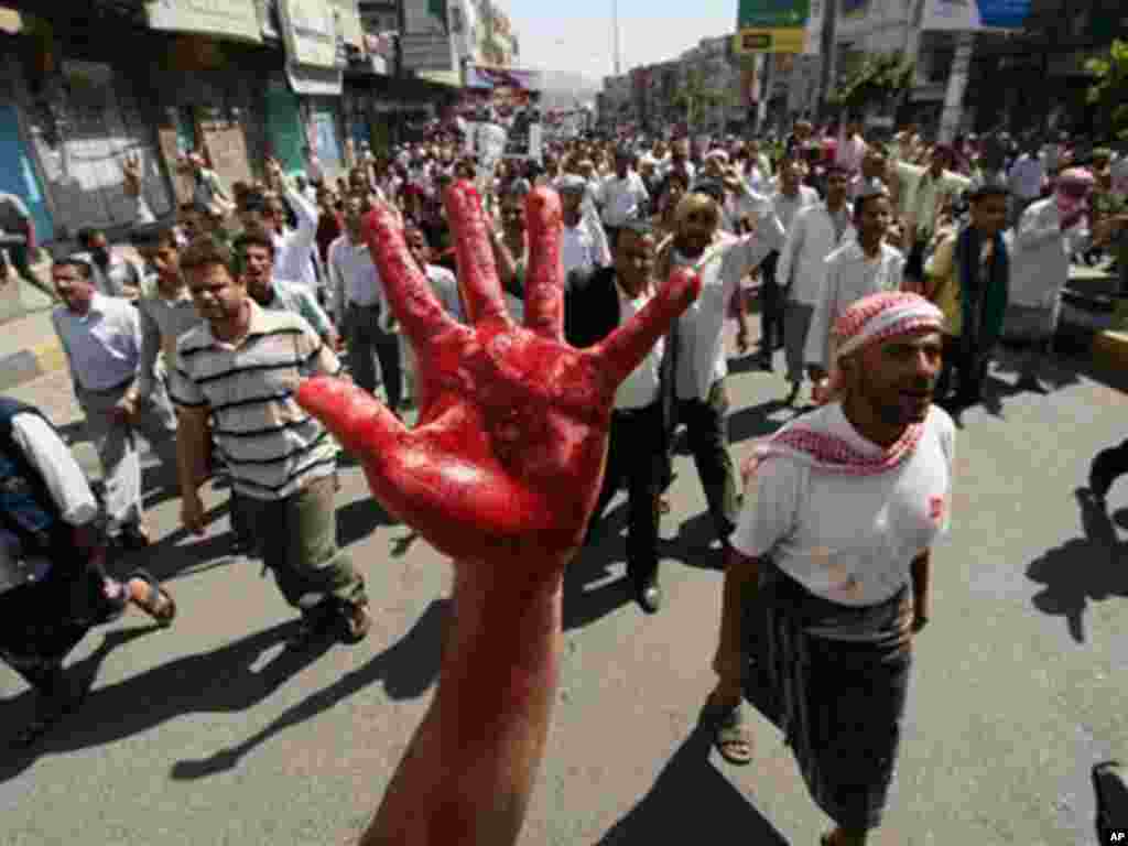 A protester shows his hand painted in red to symbolize bloodshed while demanding the resignation of Yemeni President Ali Abdullah Saleh. (AP)