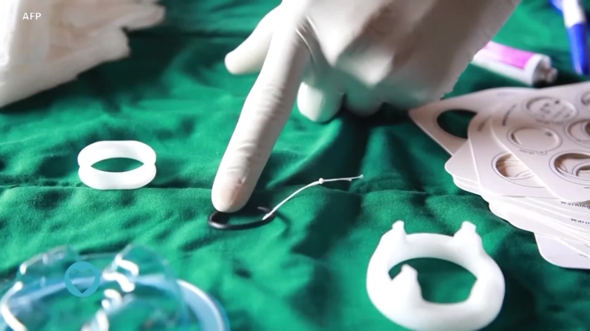 de santé la circoncision masculine