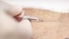 FILE - A nurse draws a blood sample for an HIV test.