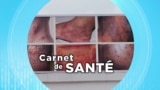 Carnet de Santé : les dangers de l'éclaircissement de la peau