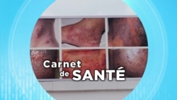 Carnet de Santé : les dangers de l'éclaircissement de la peau