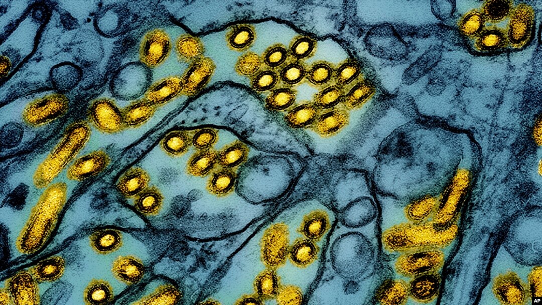 Arhiv: Obojena mikroskopska slika čestica Ptičje gripe, koju je objavio Nacionalni institut za alergije i infektivne bolesti, 26. marta 2024. (Foto: AP/CDC/NIAID)