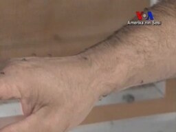 ABD'de Sivrisinek Salgını