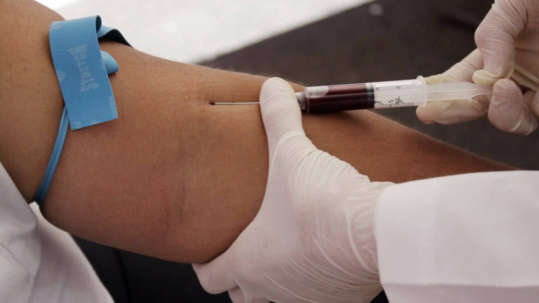 Bishkekda jinsiy aloqa