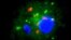 Mycobacterium tuberculosis (red) is hiding in human white blood cells (blue and green) cultured in vitamin D-deficient serum 