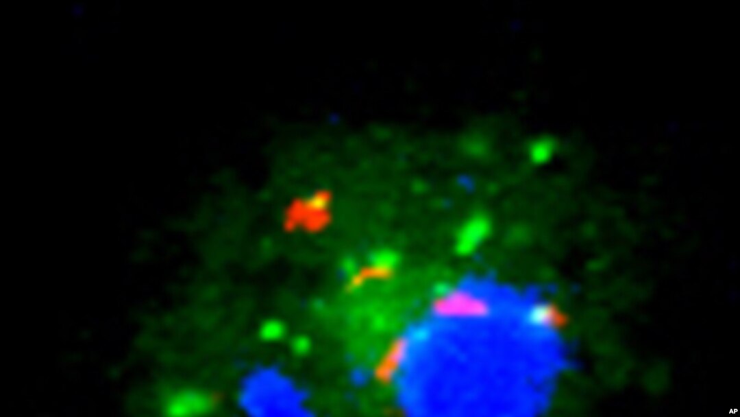 Mycobacterium tuberculosis (red) is hiding in human white blood cells (blue and green) cultured in vitamin D deficient serum so it is not being efficiently killed by cathelicidin and other proteins.