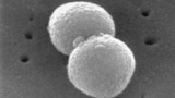 This electron microscopic image provided by the Centers for Disease Control and Prevention shows two, round-shaped, Gram-positive, Streptococcus pneumoniae bacteria. (Janice Haney Carr/CDC via AP)