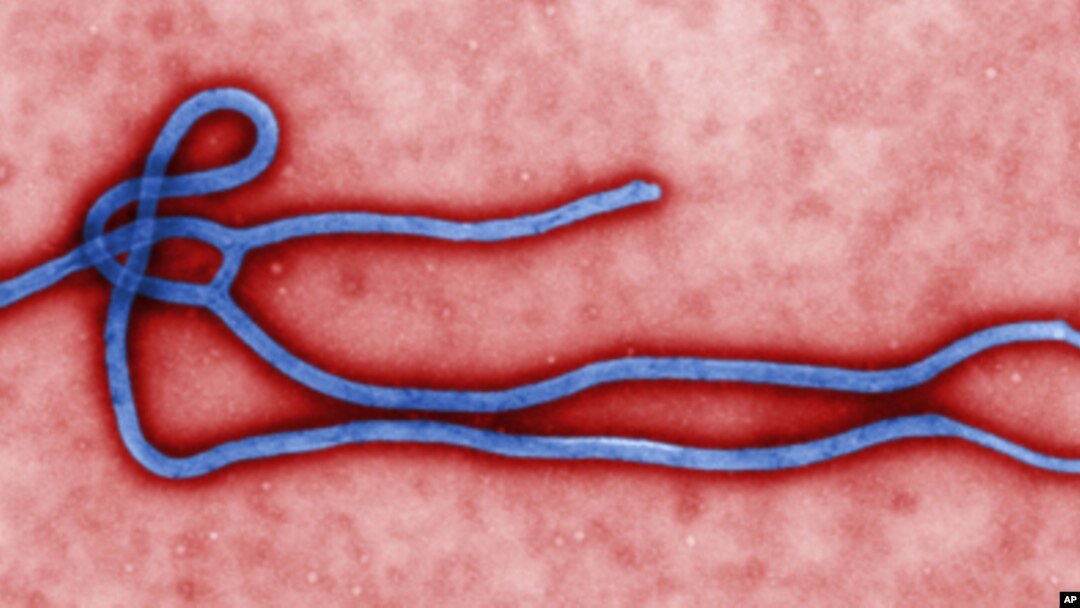 This colorized transmission electron micrograph (TEM) reveals some of the form and structure of an Ebola virus.