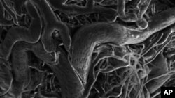 Out-of-control blood vessels associated with retinopathy as imaged by a scanning electron microscope.