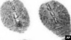 Fugitive William Keegan had all 10 fingers surgically altered in the 1990's to obliterate his fingerprints above the first joint.