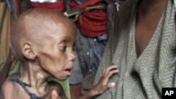 Severely malnourished child from southern Somalia is being held in a makeshift shelter in a refugee camp in Mogadishu, Somalia (File Photo - Sept. 20, 2011).