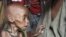 Severely malnourished child from southern Somalia is being held in a makeshift shelter in a refugee camp in Mogadishu, Somalia (File Photo - Sept. 20, 2011).