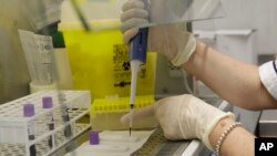 A researcher tests a patient's blood for COVID-19 at a private laboratory in Rome, May 5, 2020. 