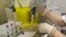 A researcher tests a patient's blood for COVID-19 at a private laboratory in Rome, May 5, 2020. 