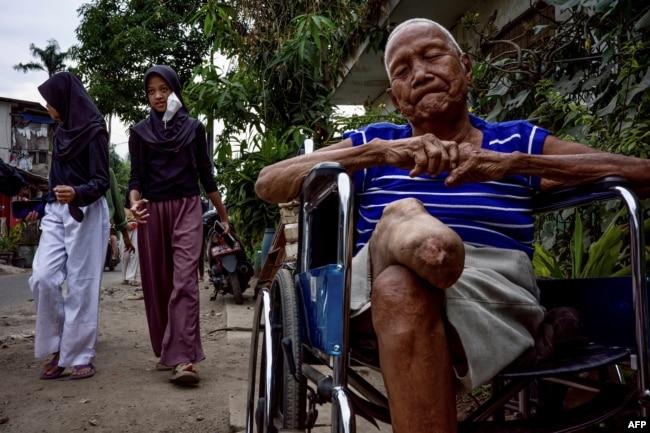 Mantan penderita kusta, Harto, duduk di kursi roda di depan rumahnya di kampung kusta di Tangerang, karena kakinya tidak kuat mengenakan kaki palsu, 18 Januari 2023, (BAY ISMOYO / AFP)