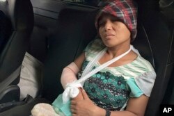 Seorang perempuan terluka dibaringkan di Lay Wah, salah satu desa di distrik Mutraw, negara bagian Karen, Myanmar, Kamis, 12 Januari 2023. (Free Burma Rangers via AP)