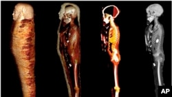 FILE: The layers of an Egyptian mummy dating to 330 BC are pictured using CT (computed tomography). In the scientific article published in the journal ‘Frontiers With Medicine’ with the photos a group of scientists from Cairo University revealed previously unknown details. 