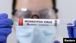 FILE - A test tube labeled "Monkeypox virus positive" is seen in this illustration made May 23, 2022. 