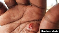 Ingxoxo Esiyenze LoMnu. Joseph Tshuma