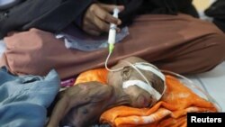  صومالیہ میں خشک سالی سے متاثر ہو کر نقل مکانی کرنے والی ایک عورت موگا دیشو کے ایک اسپتال میں اپنے بچے کو ناک کے ذریعے ٹیوب سے خوراک دے رہی ہے ۔ فوٹو رائٹرز 24ستمبر2022