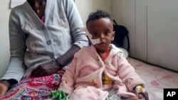 Yordanos Mebrahtiu, 1, is treated for malnutrition at the Ayder Referral Hospital in Mekele, in the Tigray region of northern Ethiopia, Oct. 4, 2022.