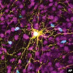 Gambar mikroskop yang disediakan oleh Pasca Lab/Stanford Medicine ini menunjukkan sel astrosit manusia, di tengah berwarna kuning, dan sel glial manusia (tersebar dalam warna biru) di dalam otak tikus. (Pasca Lab/Stanford Medicine via AP)