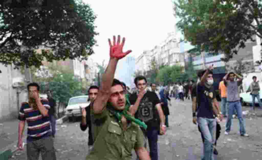 In this photograph posted on the internet, a man holds up his hand covered in blood during clashes between demonstrators and riot police in Tehran, Iran Saturday June 20, 2009. (AP Photo)