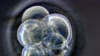 აღმოჩენა: 11 გენი, რომელსაც კიბოს მეტასტაზების შეჩერება შეუძლია - რუბრიკაში “გალილეო”