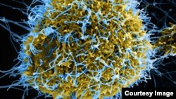 En la imagen, el virus del ébola visto al microscopio. [Foto: Cortesía NAIAD]