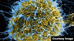 Colorized scanning electron micrograph of filamentous Ebola virus particles (blue) budding from a chronically infected VERO E6 cell (yellow-green) from the National Institute of Allergy and Infectious Diseases. (photo credit: National Institutes of Health)
