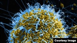 Ebola virus (NAIAD courtesy photo)