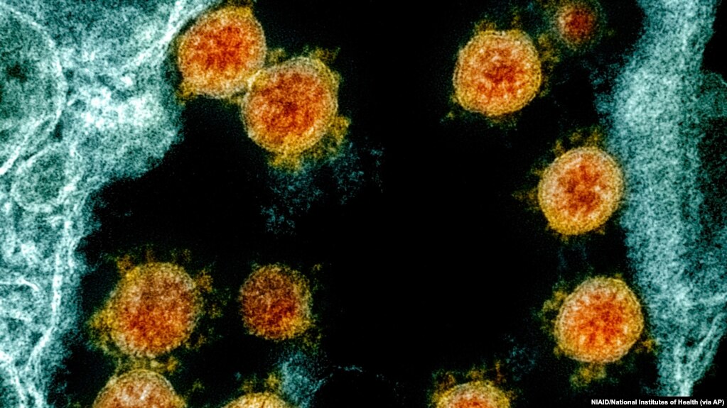 电子显微镜下的新冠病毒影像。(photo:VOA)