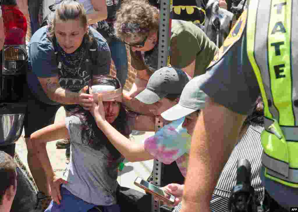 People receive first-aid after a car accident ran into a crowd of protesters in Charlottesville, Virginia, Aug. 12, 2017. . A picturesque Virginia city braced for a flood of white nationalist demonstrators as well as counter-protesters, declaring a local emergency as law enforcement attempted to quell early violent clashes.