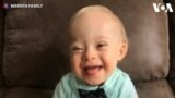 Lucas Warren, Bayi dengan Down Syndrome Duta Gerber