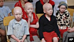 Children with albinism sit at the Golden Valley English Medium School, a school sponsored by Under the Same Sun (UTSS), in Geita, Tanzania.