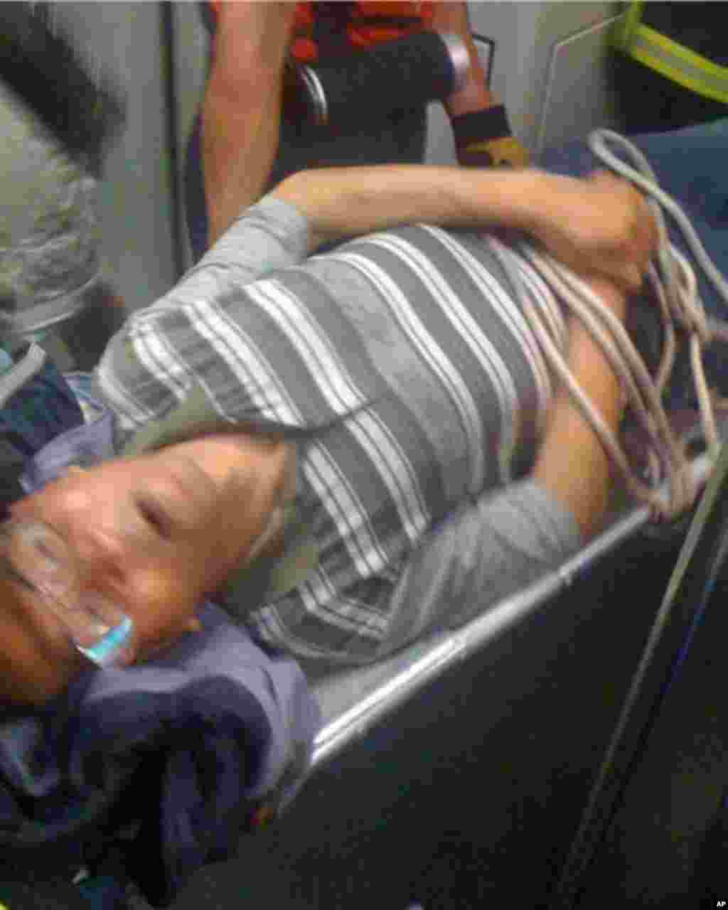 心脏病病人发作