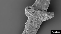 The filament of Tortotubus from the Silurian of Gotland, Sweden, showing the envelope of secondary filaments covering the main filament and primary branches and developing a distinctive pustular ornament, is shown in this image released March 2, 2016.