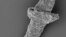 The filament of Tortotubus from the Silurian of Gotland, Sweden, showing the envelope of secondary filaments covering the main filament and primary branches and developing a distinctive pustular ornament, is shown in this image released March 2, 2016.