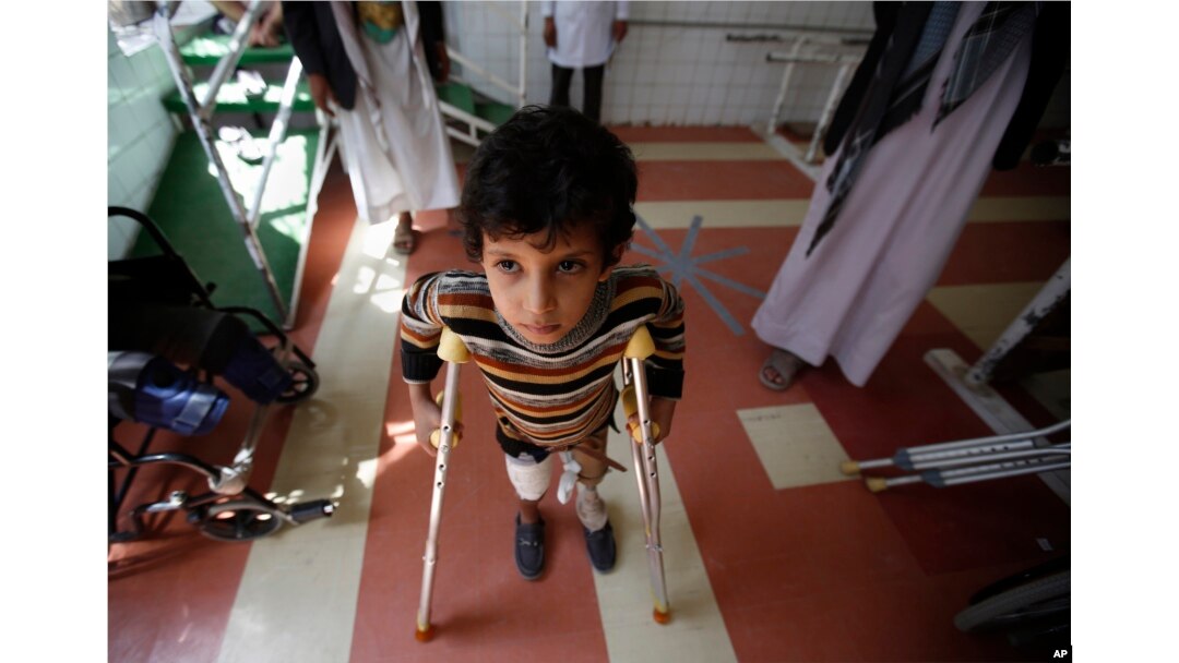 FILE - A young boy who lost his leg in the Yemen war uses a prosthetic limb at a government-run rehabilitation center in Sanaa, Yemen on March 5, 2016.