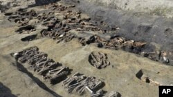 This undated photo provided Wednesday, Aug. 26, 2020, by Osaka City Cultural Properties Association shows human bones found at the north section of the "Umeda Grave" burial site in Osaka, western Japan. (Osaka City Cultural Properties Association via AP)