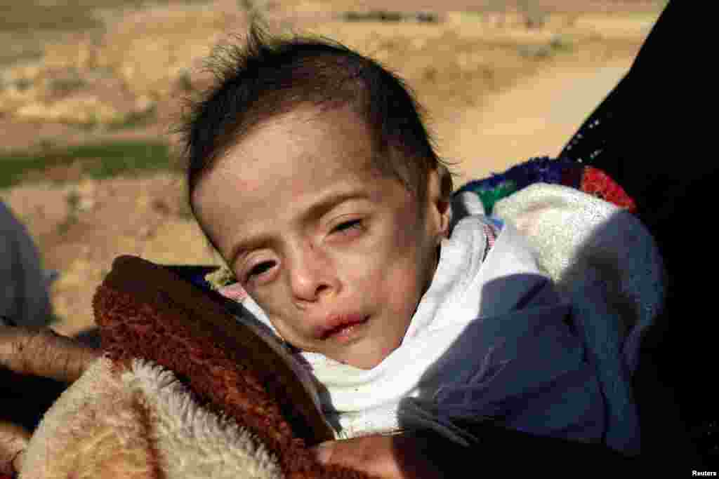 Batoul Bashir Ahmad, a five-month-old child suffering from dehydration, is carried by his mother, a displaced Iraqi woman who fled her home during a battle between Iraqi forces and Islamic State militants, in Mosul.