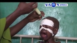 Manchetes Africanas 11 Abril 2107: ONU com dificuldades para ajudar Africa