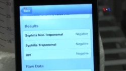 Smartfonlar HİV virusuna diaqnoz qoya biləcək