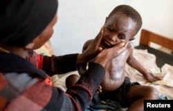 Furaha Elisabeth merawat anaknya, Sagesse Hakizimana, yang dirawat karena Mpox di pusat kesehatan Munigi, Kivu Utara, Republik Demokratik Kongo, 19 Agustus 2024. (Foto: REUTERS/Arlette Bashizi)