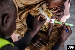 FILE - A health worker measures the circumference of a Sudanese child's arm at the clinic of a Transit Center for refugees in Renk, on February 13, 2024.