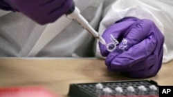 Arhiva - Fragment kosti priprema se za DNK testiranje u laboratoriji u odeljenju za sudsku medicinu u Njujorku, gde naučnici forenzičari vrše poređenje uzoraka za urorcima poginulih u terorističkom napadu 9. septembra.