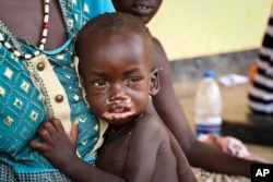 Agiu Nyang, 1, who is sick with measles, sits on the lap of his mother Amel Makir at the hospital in Kuajok, South Sudan, April 16, 2019.